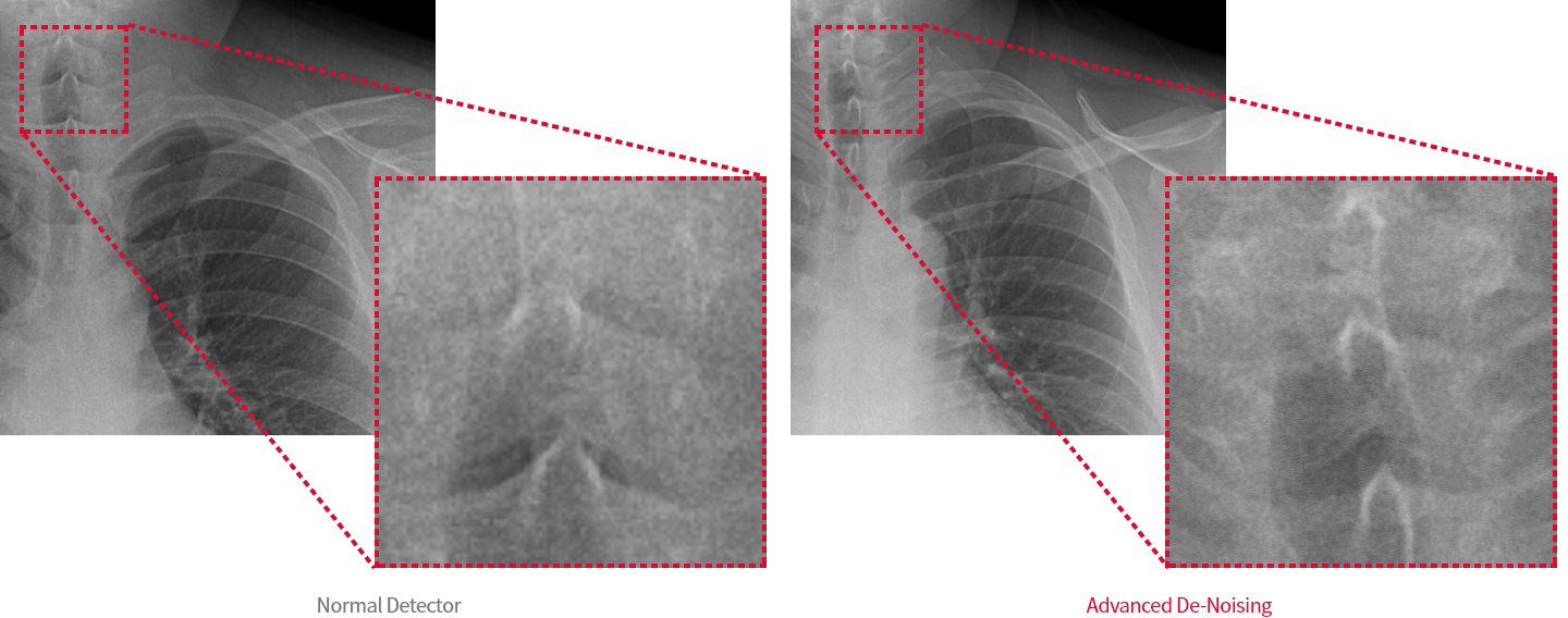 Normal Detector and Advanced De-Noising