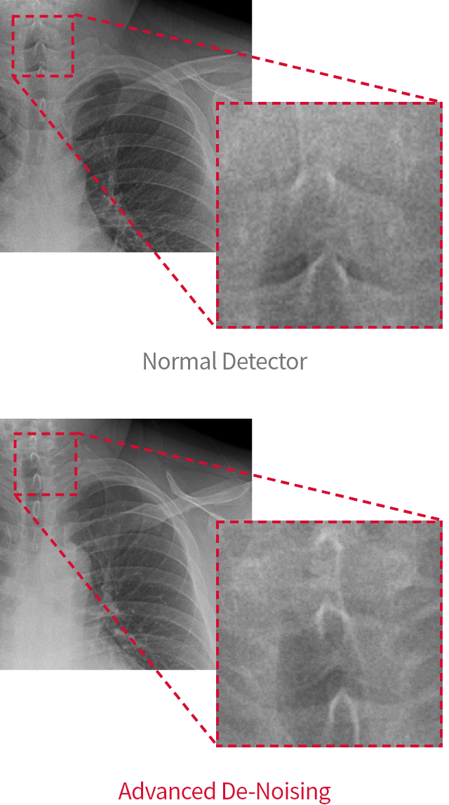 通常のディテクターとAdvanced De-Noising