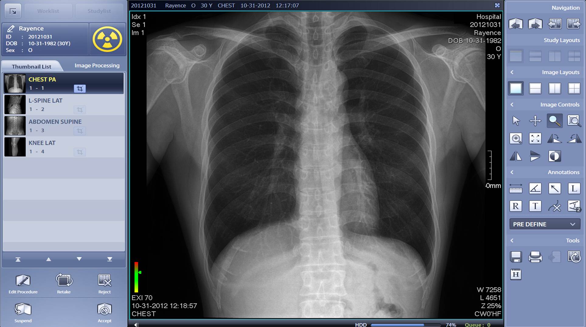 view x-rays in cdr dicom server view x-rays in cdr dicom server