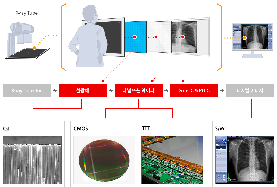 x-ray 구조도