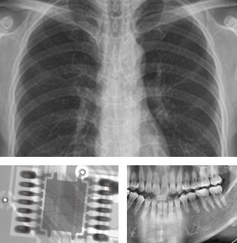 x-ray 사진